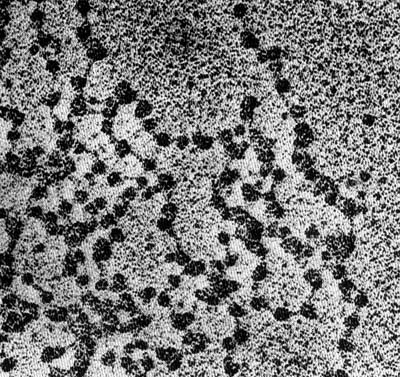 Nucleosomas vistos al microscopio electrnico, formando un "collar de perlas".