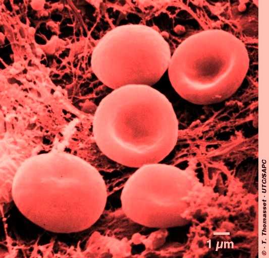 La hemoglobina de los glbulos rojos transporta oxgeno.