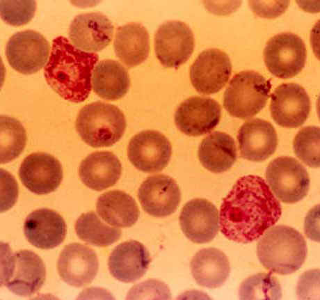 Glbulos rojos y Plasmodium falciparum