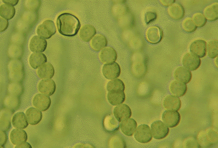 Nostoc es un tipo de alga cianofcea