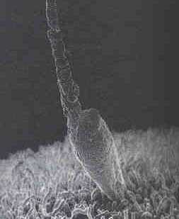 Slo un espermatozoide es capaz de introducir su material gentico en el ovocito.