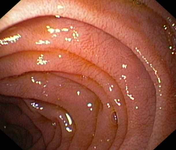Mucosa gstrica