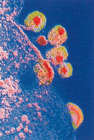 Virus infectando una clula
