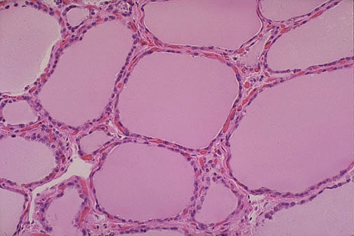 folculos del Tiroides al microscopio