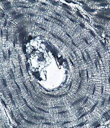 Tejido seo compacto, visto al microscopio