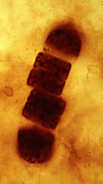 "Microfósiles de Bitter Springs Chert, primeros restos de seres vivos conocidos. Tomada de www.ucmp.berkeley.edu"