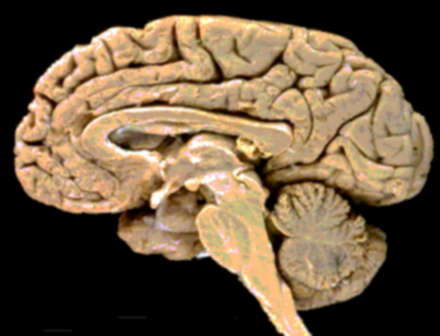 Seccin de cerebro humano