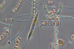 Fitoplanton de la especie de diatomeas "Rhizosolenia setigera". | Karl Bruun
